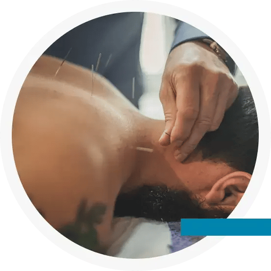 Acupuncture&DryNeedling_Overview