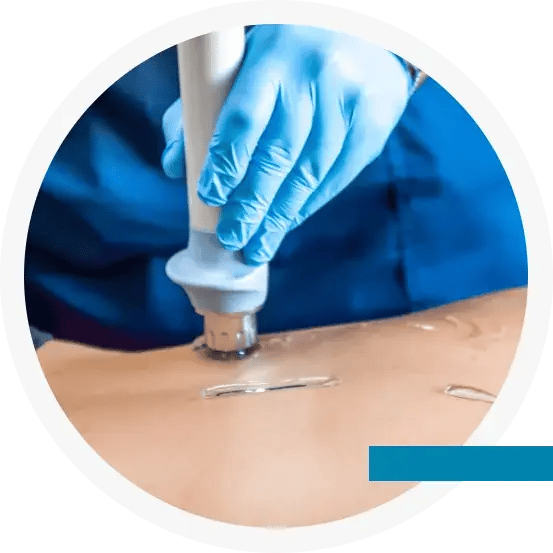 ShockwaveTherapy_Process