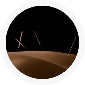 Acupuncture & Dry Needling