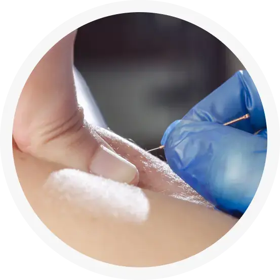 Biomedical Acupuncture-- Biomedical Acupuncture--